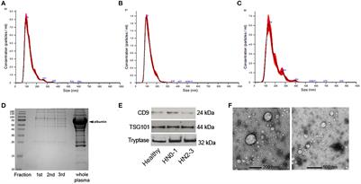 Plasma small extracellular vesicles from dogs affected by cutaneous mast cell tumors deliver high levels of miR-21-5p